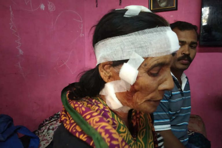 ७० वर्षांच्या आजींनी बिबट्यावर प्रतिहल्ला करत वाचवले स्वत:चे प्राण-बिबट्या जेरबंद…